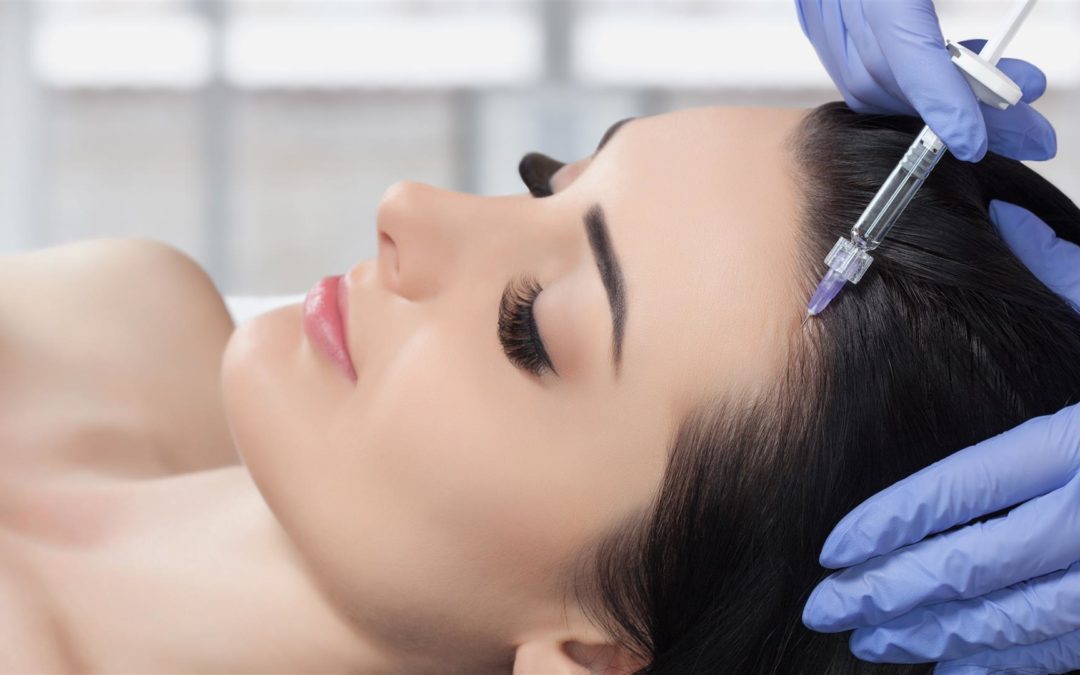 PRP Therapie gegen Haarausfall